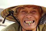 Show off your grille-permanent-gold-teeth.jpg